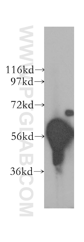Western Blot (WB) analysis of mouse testis tissue using DYRK1B Polyclonal antibody (12240-1-AP)