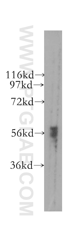 Western Blot (WB) analysis of mouse skeletal muscle tissue using DYRK1B Polyclonal antibody (12240-1-AP)