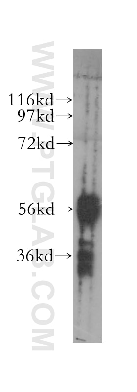 Western Blot (WB) analysis of human colon tissue using DYRK1B Polyclonal antibody (12240-1-AP)