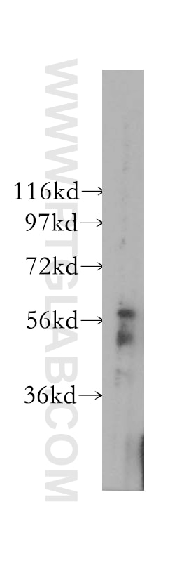 Western Blot (WB) analysis of human heart tissue using DYRK1B Polyclonal antibody (12240-1-AP)