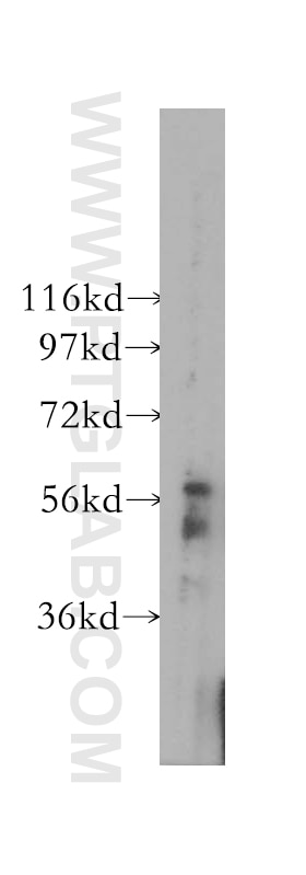 WB analysis of human heart using 12240-1-AP