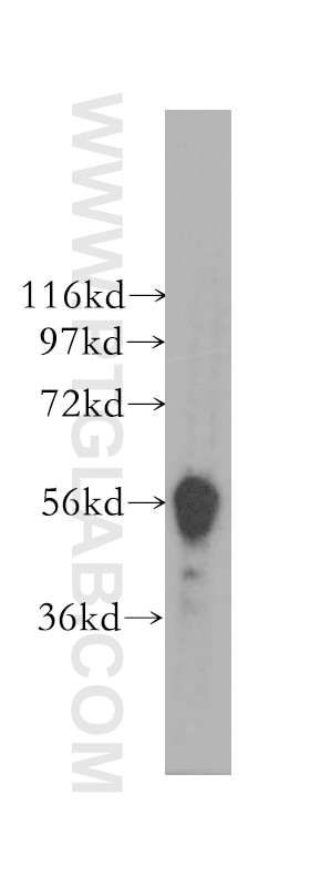 Western Blot (WB) analysis of HeLa cells using DYRK1B Polyclonal antibody (12240-1-AP)