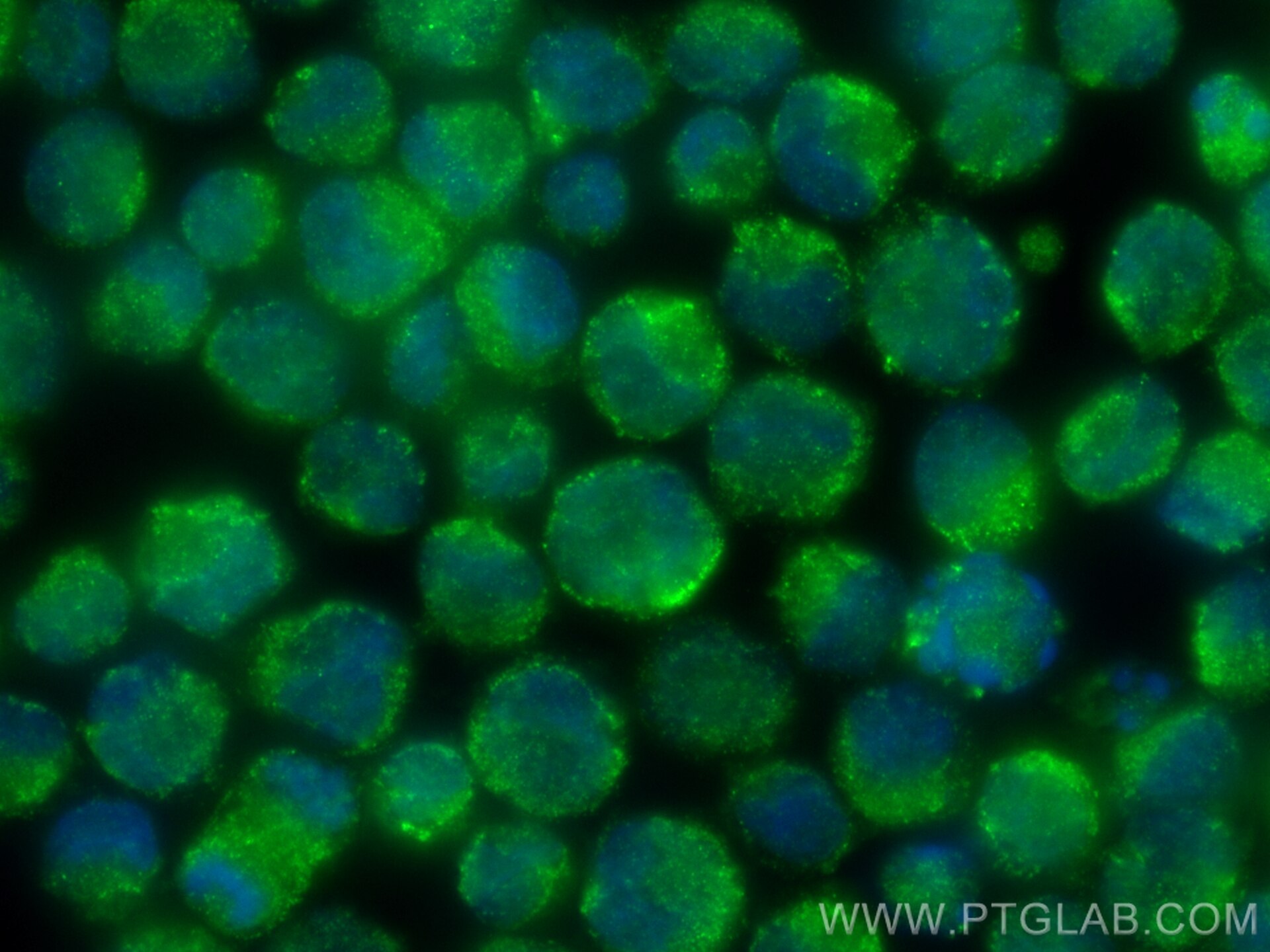 Immunofluorescence (IF) / fluorescent staining of K-562 cells using DYRK2 Polyclonal antibody (21979-1-AP)