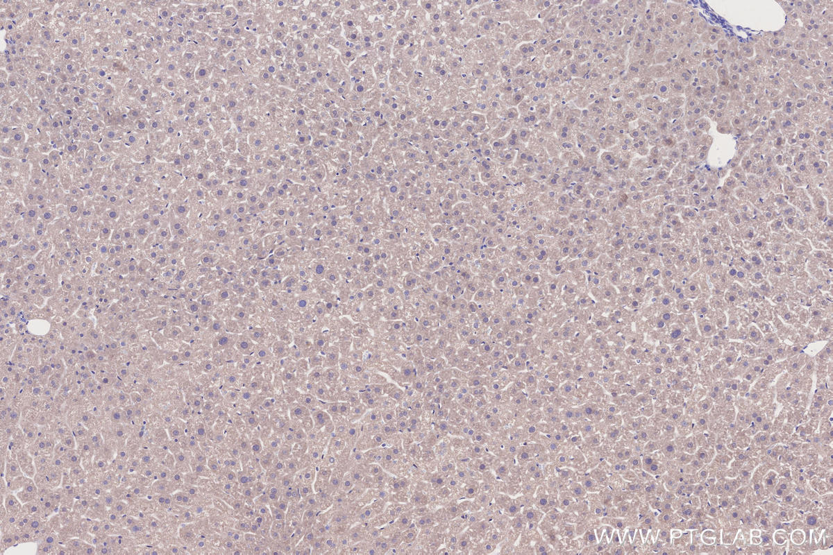 IHC staining of mouse liver using 21979-1-AP Immunohistochemistry (IHC) staining of mouse liver tissue using DYRK2 Polyclonal antibody (21979-1-AP)
