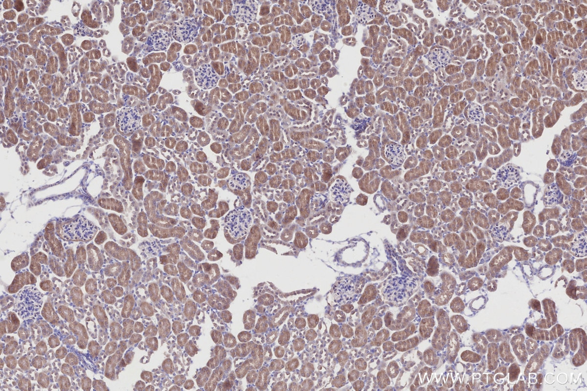 IHC staining of mouse kidney using 21979-1-AP Immunohistochemistry (IHC) staining of mouse kidney tissue using DYRK2 Polyclonal antibody (21979-1-AP)