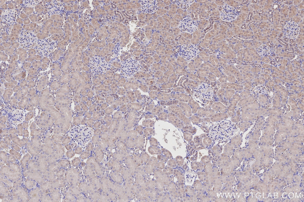 IHC staining of rat kidney using 21979-1-AP Immunohistochemistry (IHC) staining of rat kidney tissue using DYRK2 Polyclonal antibody (21979-1-AP)