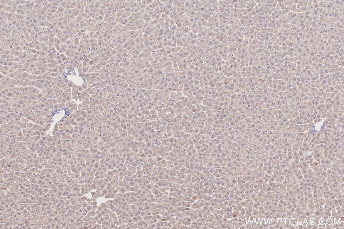 IHC staining of rat liver using 21979-1-AP Immunohistochemistry (IHC) staining of rat liver tissue using DYRK2 Polyclonal antibody (21979-1-AP)