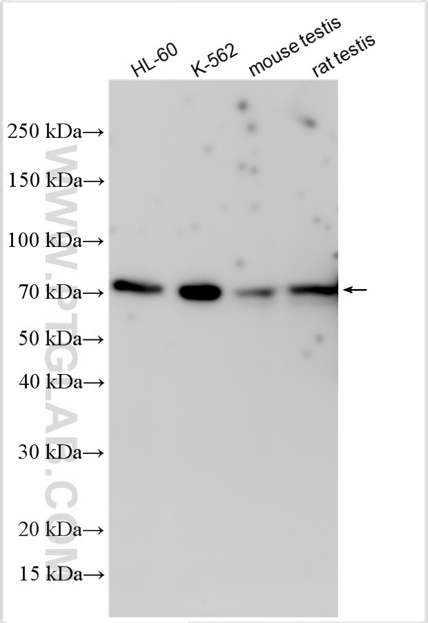 Western Blot (WB) analysis of various lysates using DYRK2 Polyclonal antibody (21979-1-AP)