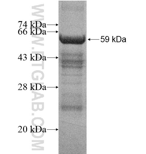 DYRK2 fusion protein Ag13480 SDS-PAGE