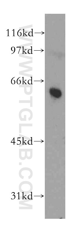 Western Blot (WB) analysis of mouse testis tissue using DYRK4 Polyclonal antibody (12890-2-AP)