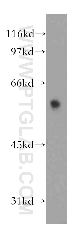 Western Blot (WB) analysis of human brain tissue using DYRK4 Polyclonal antibody (12890-2-AP)