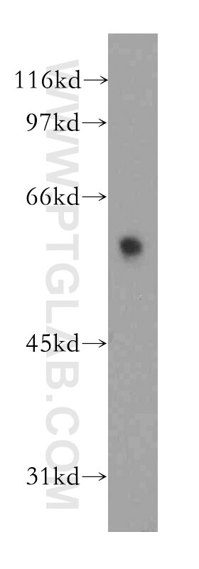 Western Blot (WB) analysis of human brain tissue using DYRK4 Polyclonal antibody (12890-2-AP)