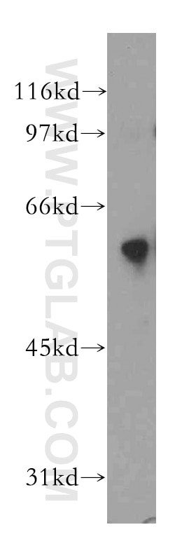 Western Blot (WB) analysis of mouse lung tissue using DYRK4 Polyclonal antibody (12890-2-AP)