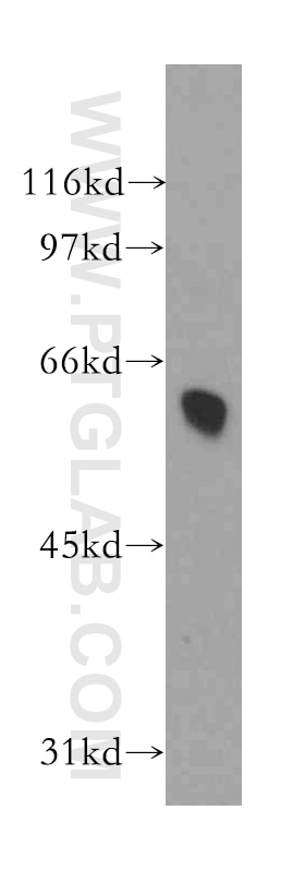 Western Blot (WB) analysis of Jurkat cells using DYRK4 Polyclonal antibody (12890-2-AP)