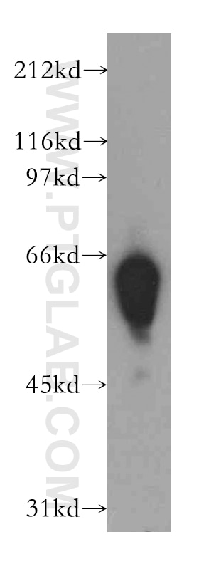 Western Blot (WB) analysis of U-937 cells using DYRK4 Polyclonal antibody (12890-2-AP)
