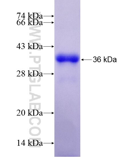 DYRK4 fusion protein Ag20395 SDS-PAGE