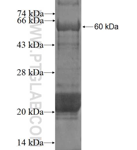 DYRK4 fusion protein Ag3515 SDS-PAGE