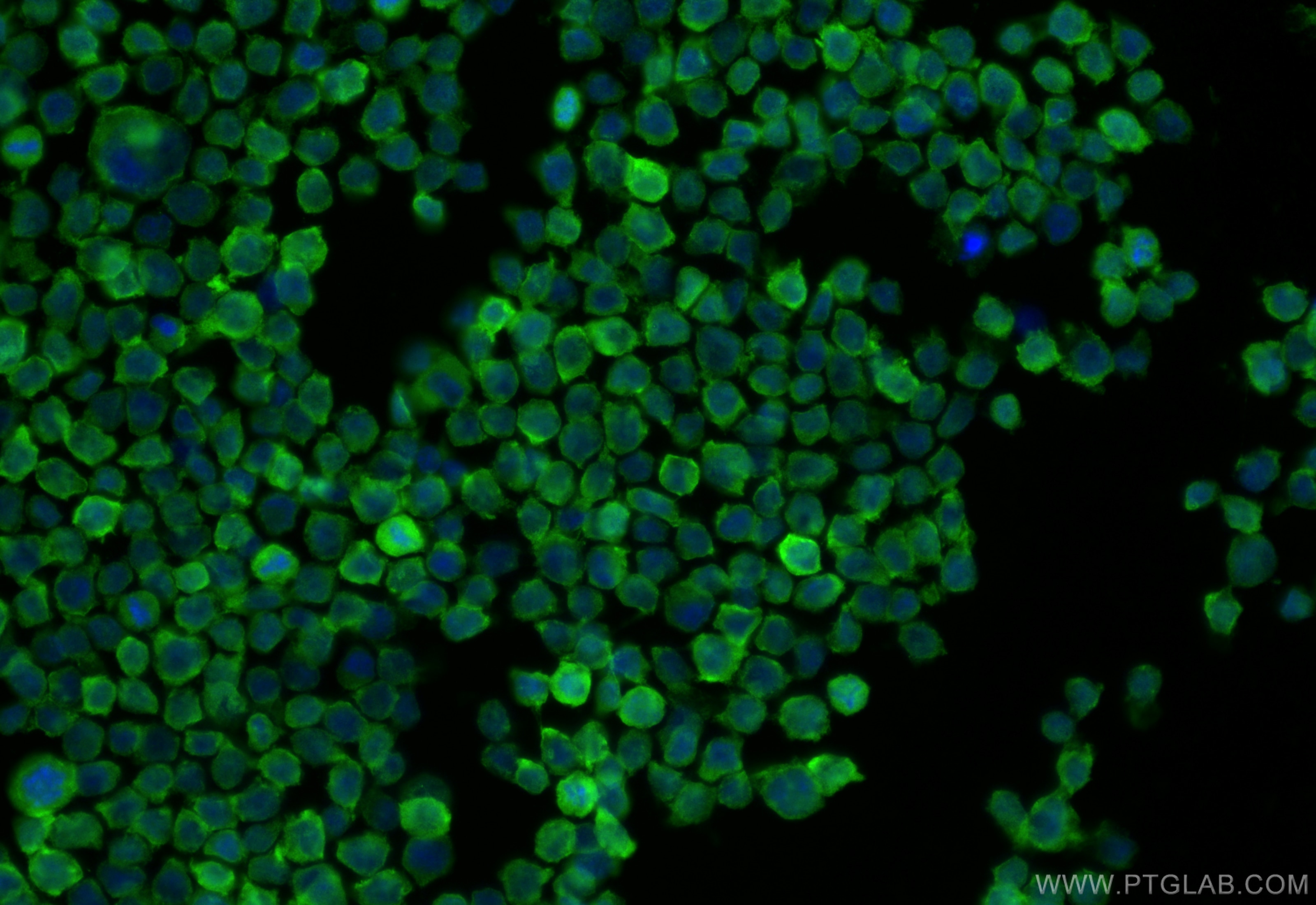 Immunofluorescence (IF) / fluorescent staining of THP-1 cells using DYSFIP1 Polyclonal antibody (18208-1-AP)