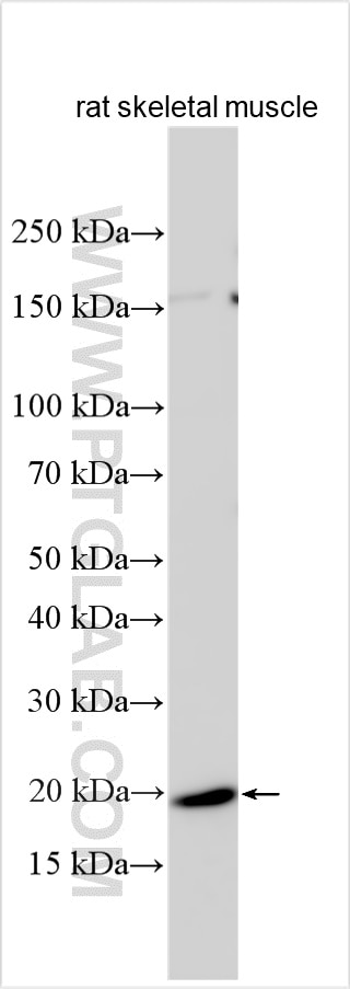 Western Blot (WB) analysis of various lysates using DYSFIP1 Polyclonal antibody (18208-1-AP)