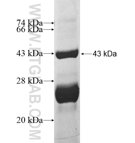 DYSFIP1 fusion protein Ag12839 SDS-PAGE
