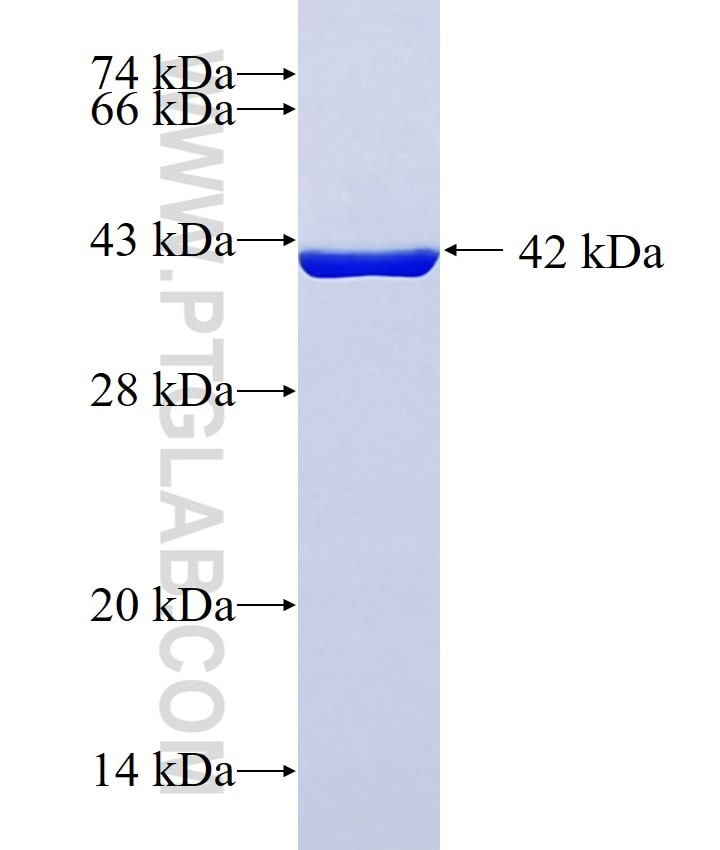 DYSFIP1 fusion protein Ag12839 SDS-PAGE