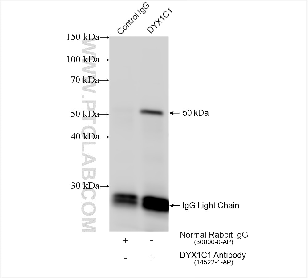 Immunoprecipitation (IP) experiment of mouse testis tissue using DYX1C1 Polyclonal antibody (14522-1-AP)
