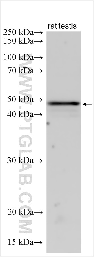 Western Blot (WB) analysis of various lysates using DYX1C1 Polyclonal antibody (14522-1-AP)