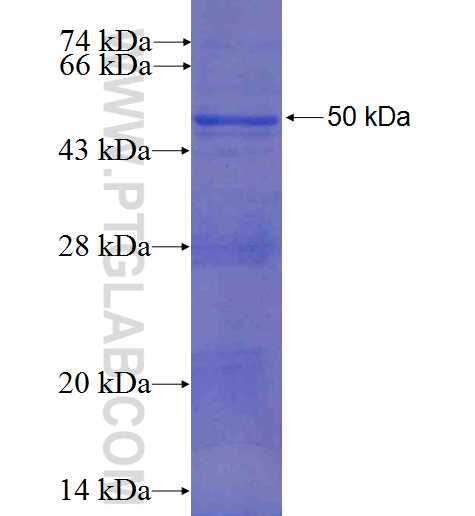 DYX1C1 fusion protein Ag5997 SDS-PAGE