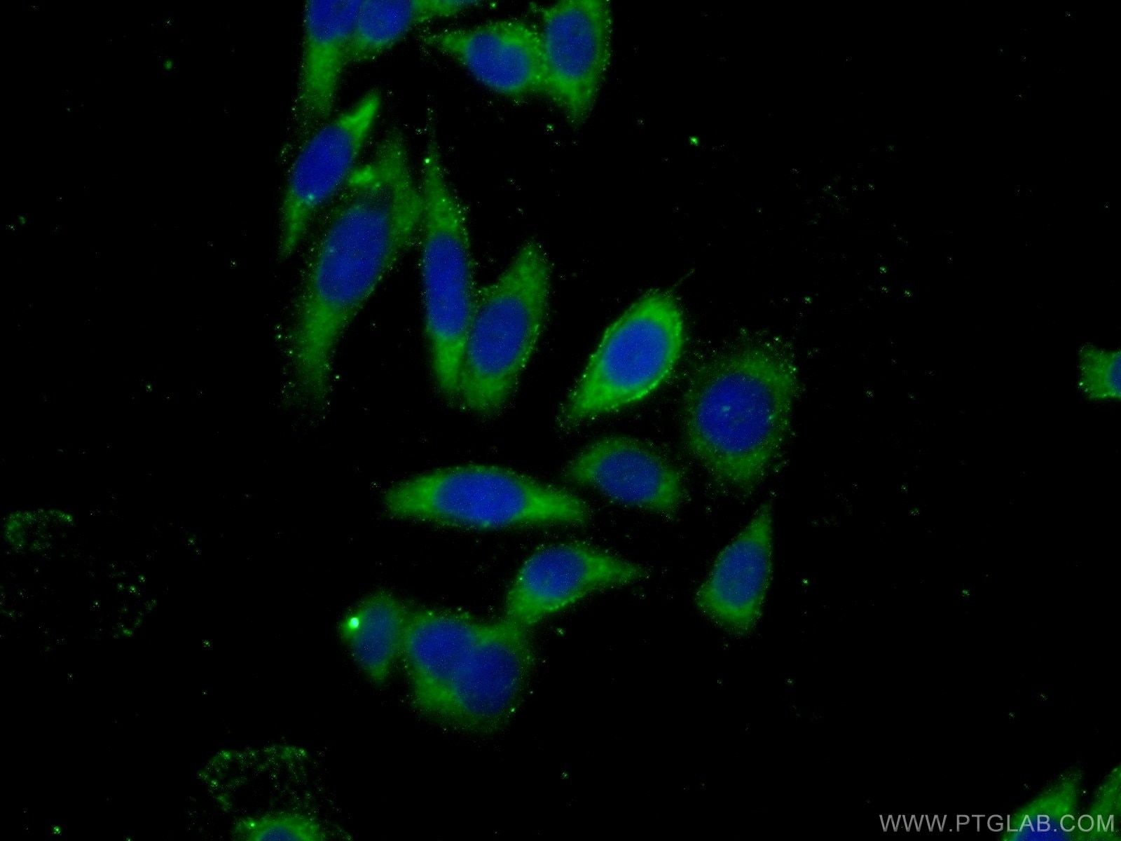 Immunofluorescence (IF) / fluorescent staining of PC-3 cells using DZIP1 Polyclonal antibody (13779-1-AP)