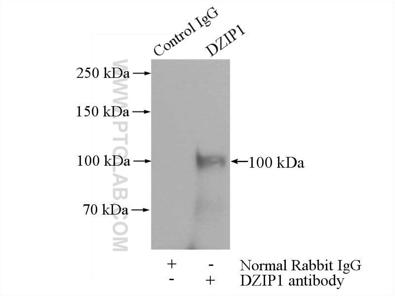 Immunoprecipitation (IP) experiment of HEK-293 cells using DZIP1 Polyclonal antibody (13779-1-AP)