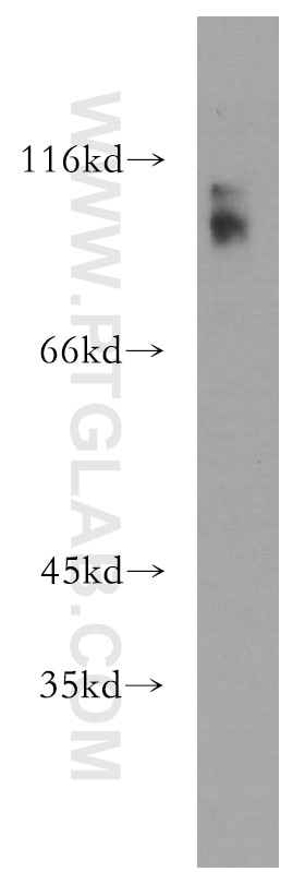 Western Blot (WB) analysis of human brain tissue using DZIP1 Polyclonal antibody (13779-1-AP)