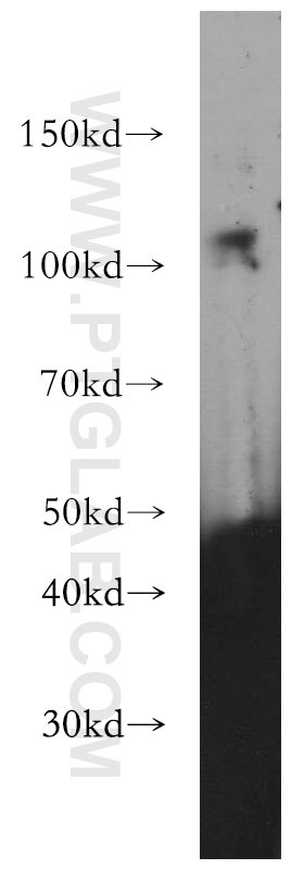 Western Blot (WB) analysis of PC-3 cells using DZIP1 Polyclonal antibody (13779-1-AP)