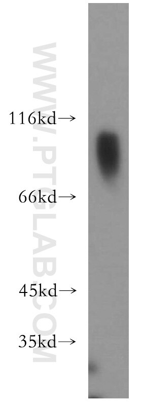 Western Blot (WB) analysis of human testis tissue using DZIP1 Polyclonal antibody (13779-1-AP)