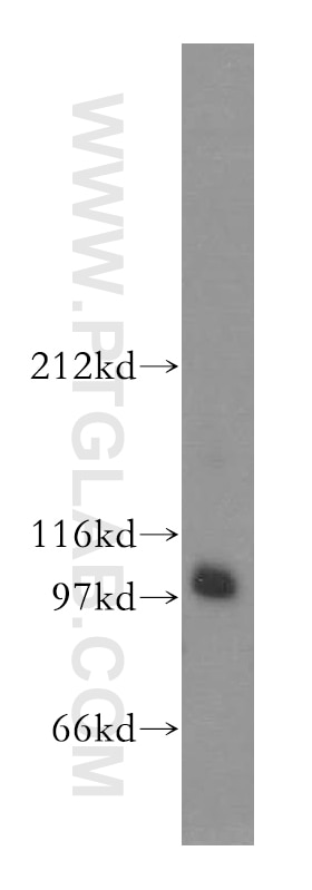 Western Blot (WB) analysis of mouse skeletal muscle tissue using DZIP1 Polyclonal antibody (13779-1-AP)