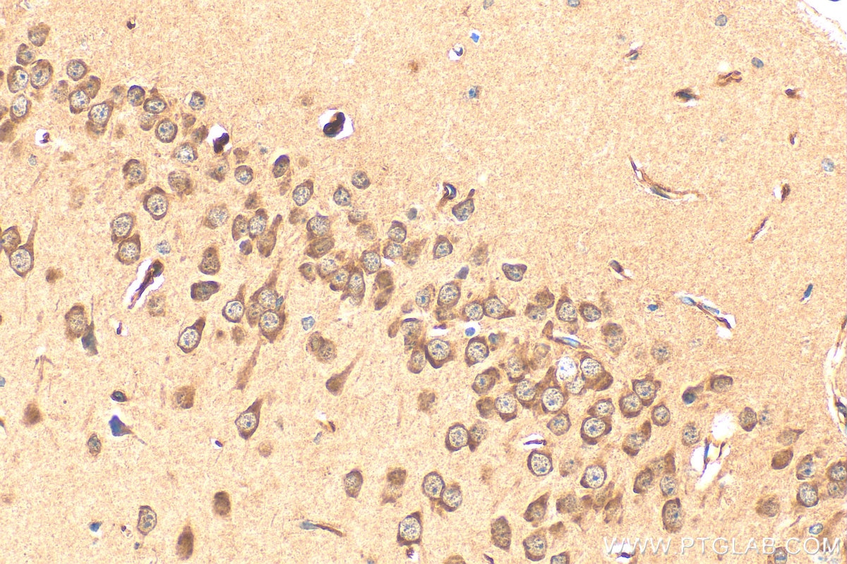 Immunohistochemistry (IHC) staining of mouse brain tissue using DZIP1L Polyclonal antibody (17274-1-AP)