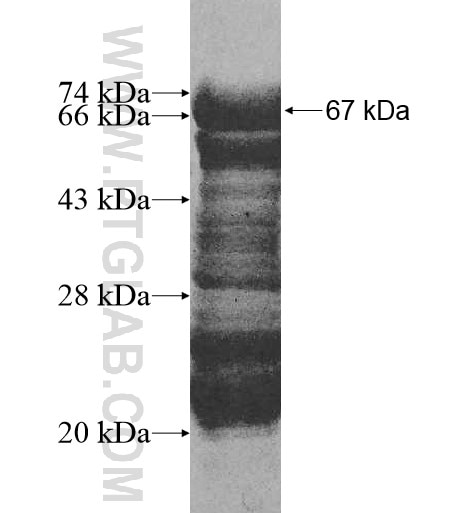 DZIP1L fusion protein Ag11034 SDS-PAGE