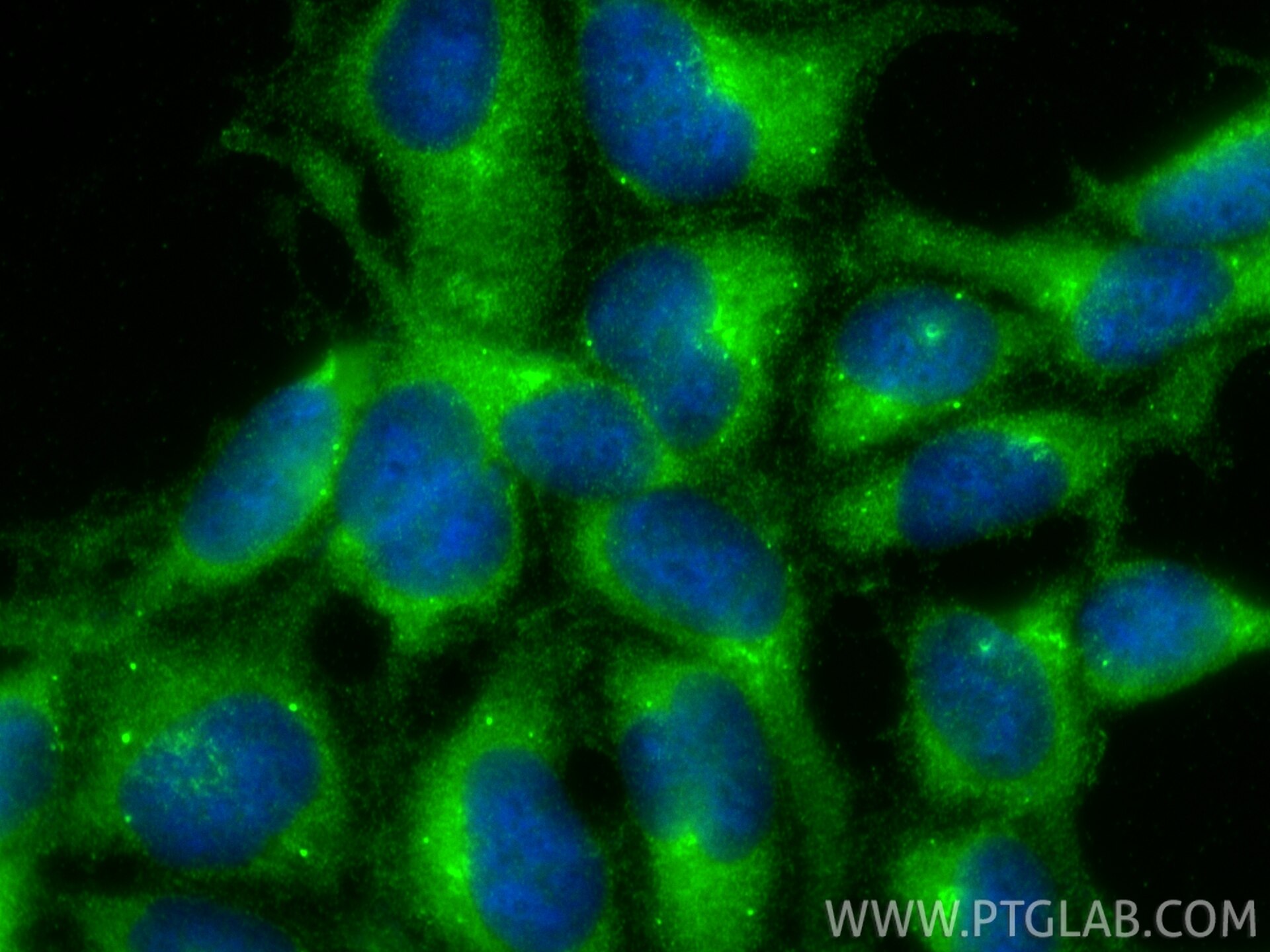 Immunofluorescence (IF) / fluorescent staining of HEK-293 cells using DZIP3 Polyclonal antibody (33563-1-AP)