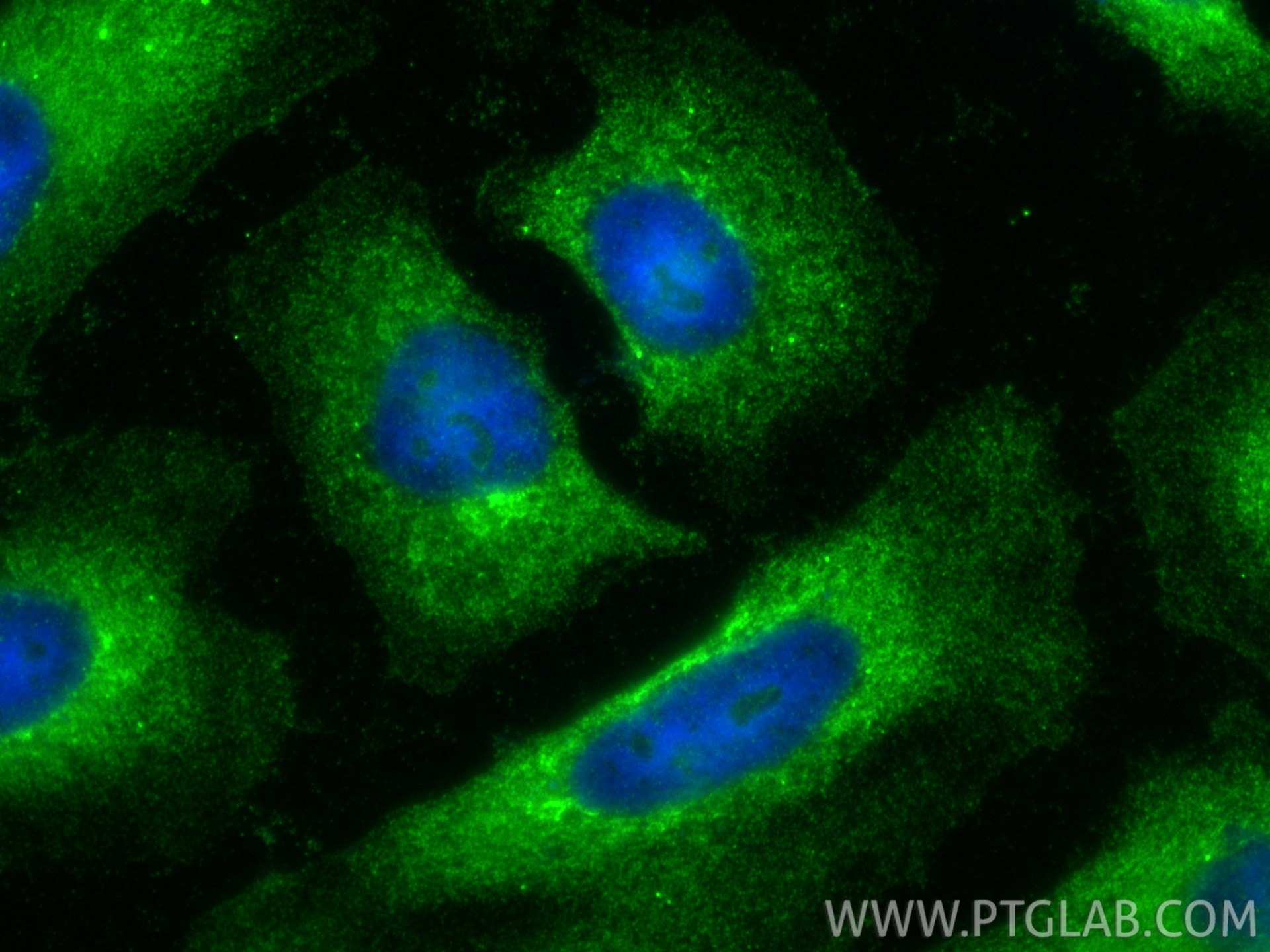 Immunofluorescence (IF) / fluorescent staining of HeLa cells using DZIP3 Polyclonal antibody (33563-1-AP)
