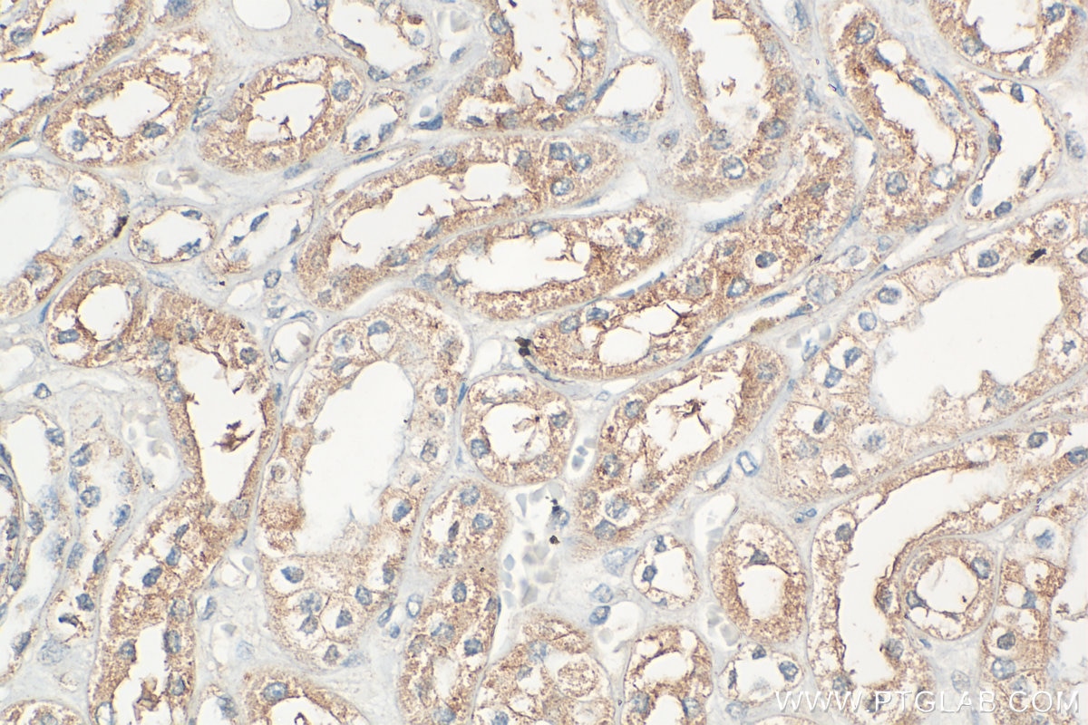 Immunohistochemistry (IHC) staining of human kidney tissue using DZIP3 Polyclonal antibody (33563-1-AP)