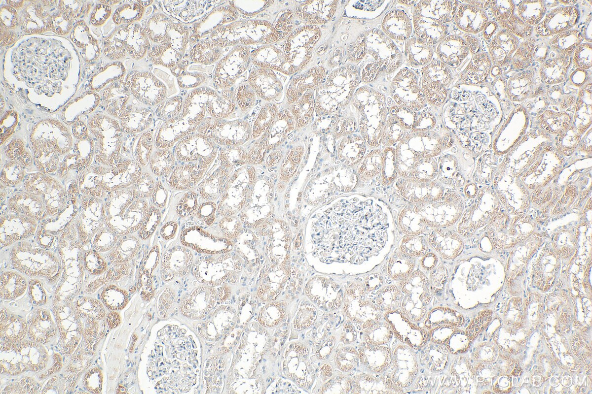 Immunohistochemistry (IHC) staining of human kidney tissue using DZIP3 Polyclonal antibody (33563-1-AP)
