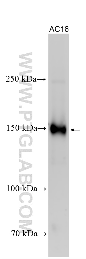 Western Blot (WB) analysis of various lysates using DZIP3 Polyclonal antibody (33563-1-AP)