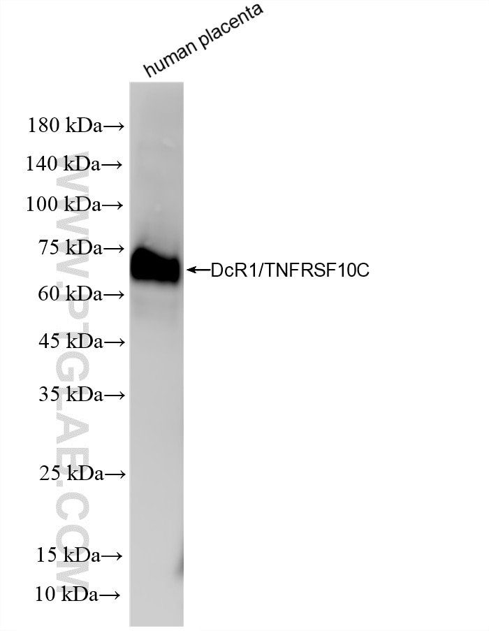 Human placenta tissue lysate was subjected to SDS PAGE followed by western blot with 86886-1-RR (DcR1/TNFRSF10C antibody) at dilution of 1:2000 incubated at room temperature for 1.5 hours. This data was developed using the same antibody clone with 86886-1-PBS in a different storage buffer formulation. Western Blot (WB) analysis of various lysates using DcR1/TNFRSF10C Recombinant monoclonal antibody (86886-1-RR)