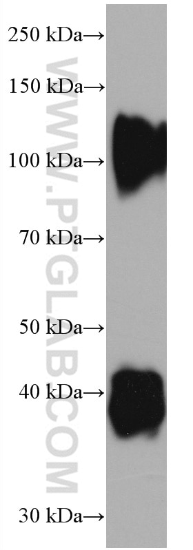 Western Blot (WB) analysis of pig cartilage tissue using Decorin Monoclonal antibody (66847-1-Ig)