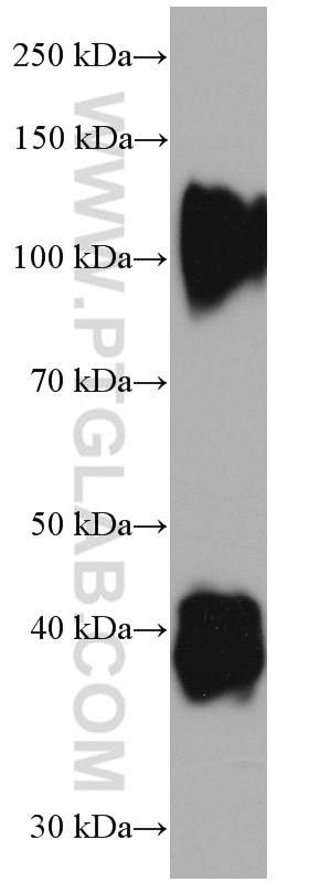 WB analysis of pig cartilage using 66847-1-Ig