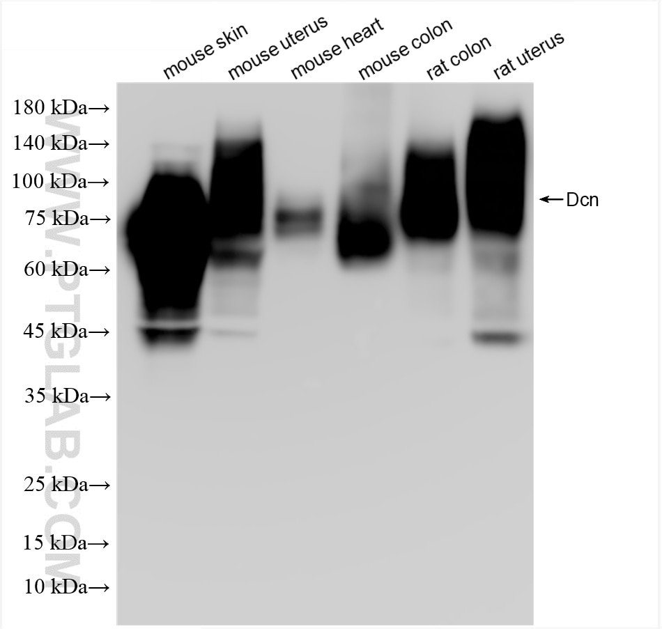 Western Blot (WB) analysis of various lysates using Decorin Recombinant antibody (85737-4-RR)