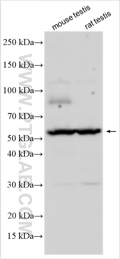 WB analysis using 33161-1-AP Western Blot (WB) analysis of various lysates using Dectin-1 Polyclonal antibody (33161-1-AP)