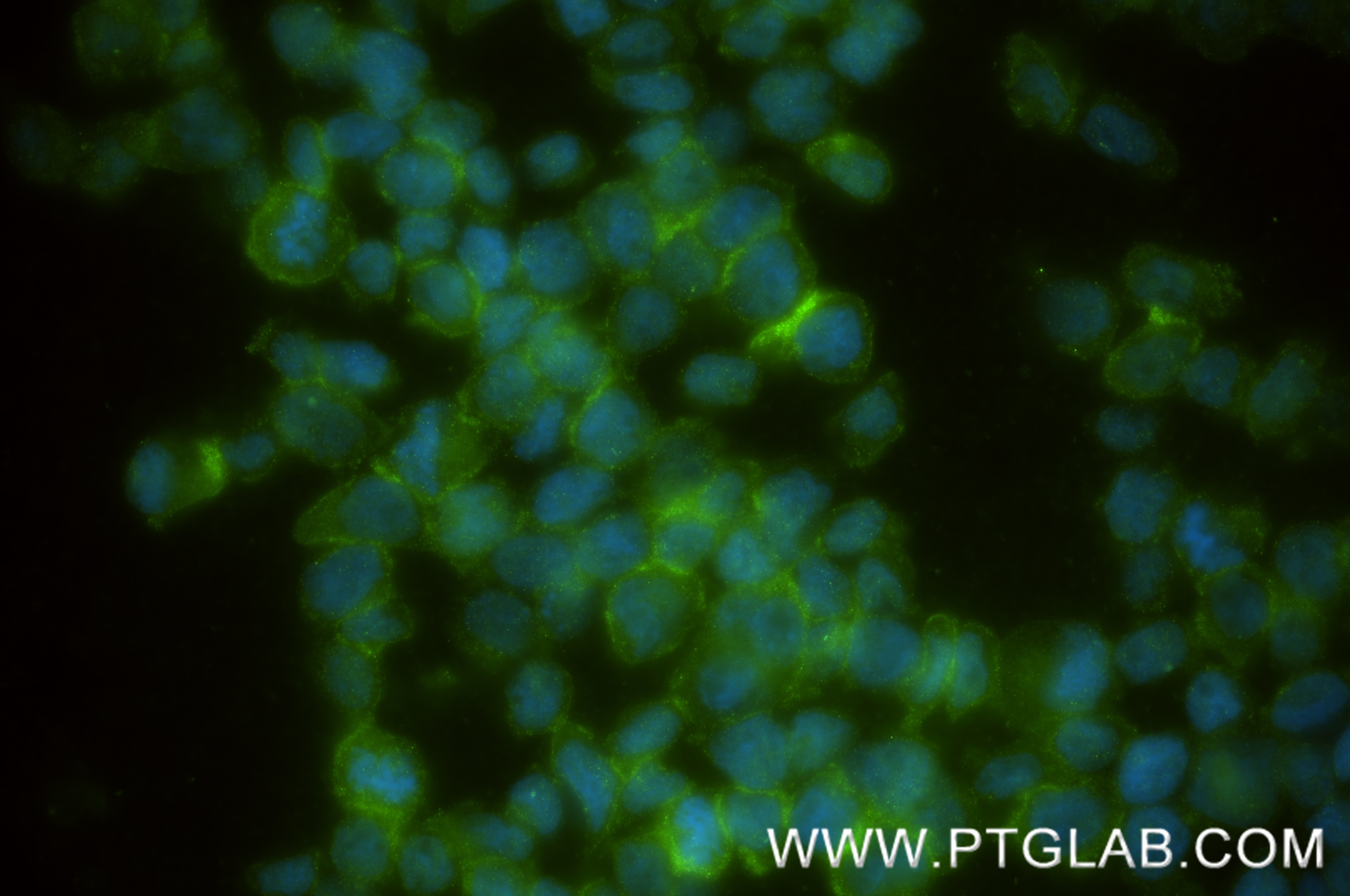 IF Staining of THP-1 using 83739-3-RR Immunofluorescence (IF) / fluorescent staining of THP-1 cells using Dectin-1/CLEC7A Recombinant monoclonal antibody (83739-3-RR)