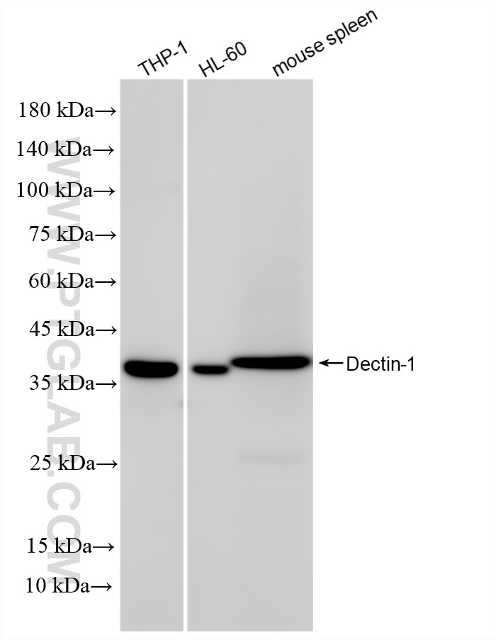 WB analysis using 83739-3-RR (same clone as 83739-3-PBS) Western Blot (WB) analysis of various lysates using Dectin-1/CLEC7A Recombinant monoclonal antibody (83739-3-RR)