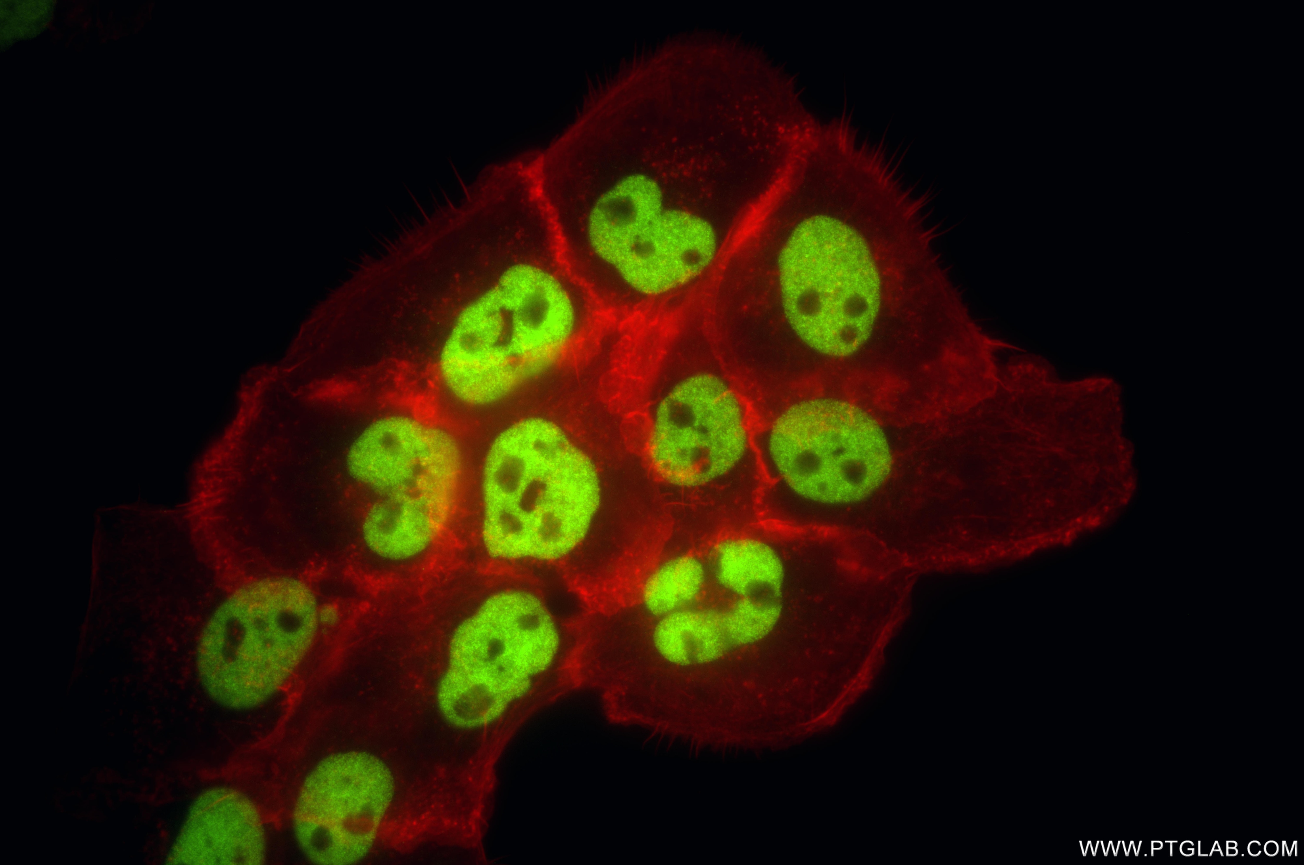 Immunofluorescence (IF) / fluorescent staining of A431 cells using DeltaN p63 Recombinant monoclonal antibody (86154-11-RR)