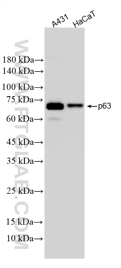 Western Blot (WB) analysis of various lysates using DeltaN p63 Recombinant monoclonal antibody (86154-11-RR)